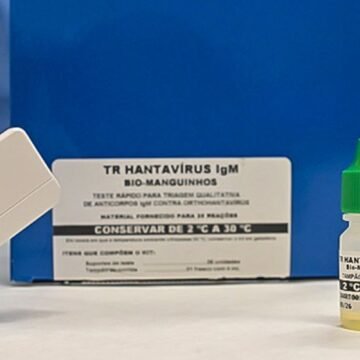 Diagnóstico Rápido: Novo Teste Identifica Hantavirose em Apenas 20 Minutos