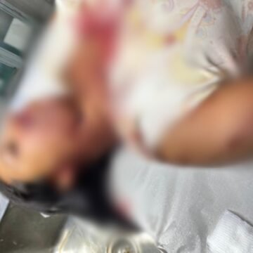 Mulher em Pontalinda sofre ataque com barra de ferro; investigação aponta ex-namorado como principal suspeito